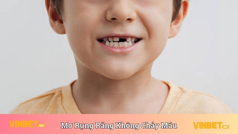 Mơ rụng răng không chảy máu thể hiện cho ý nghĩa may mắn 